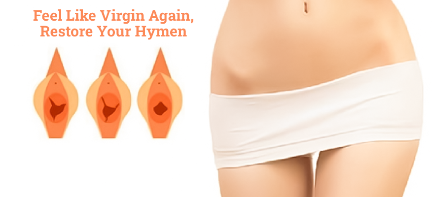 Hymenoplasty illustration